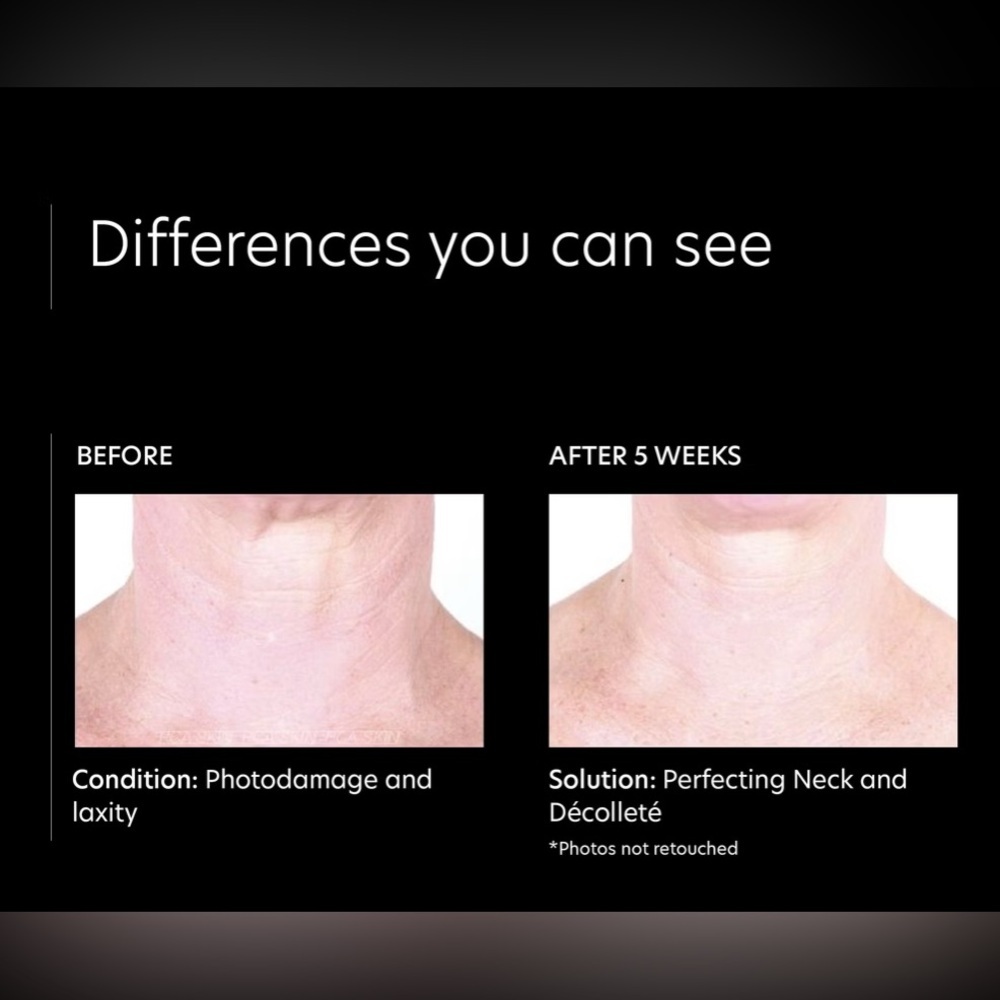 PCA Skin Perfecting Neck & Décolleté Cream NIB - Picture 4 of 6